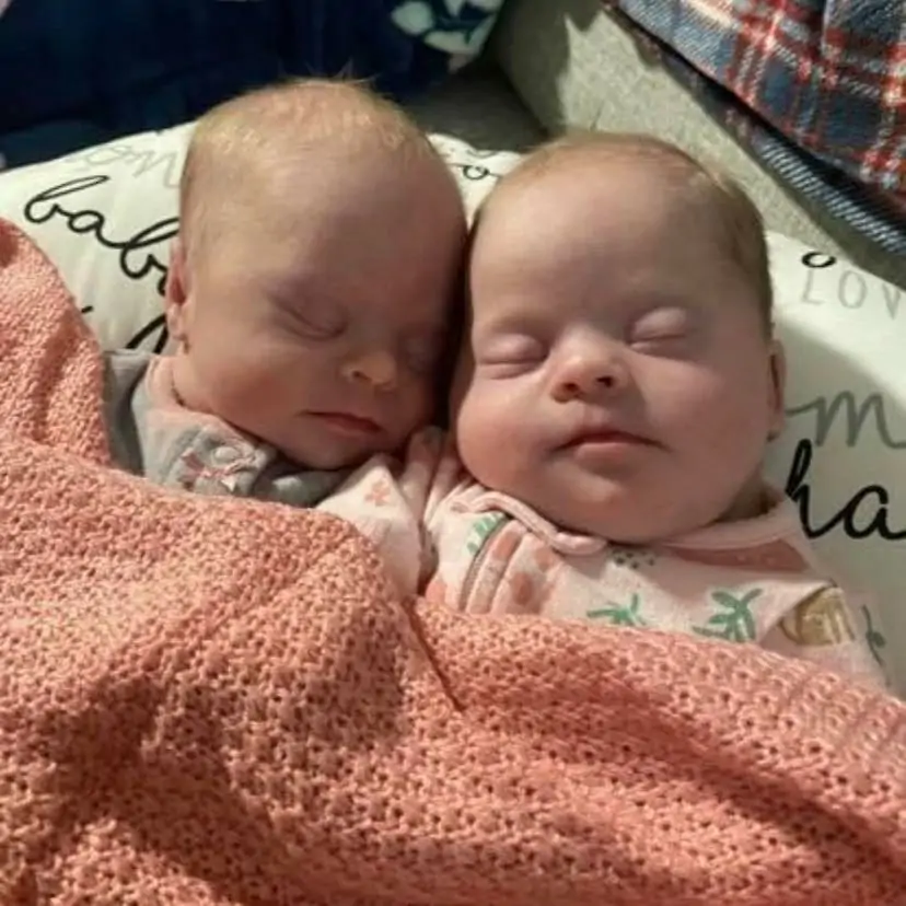 To silence critics, the mother of atypical Down syndrome twins displays how beautiful and precious they are.